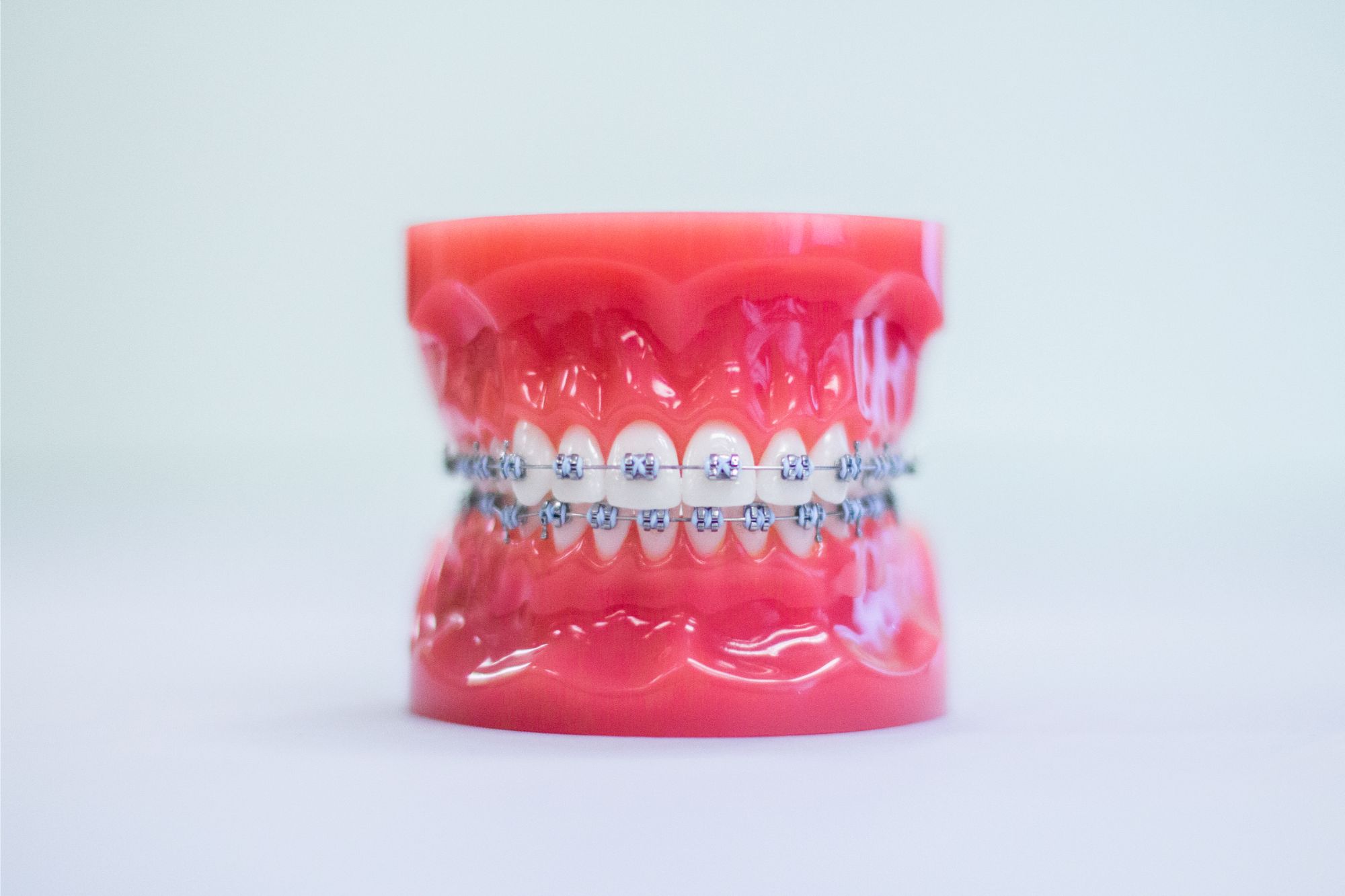 orthodontics minneapolis metal braces