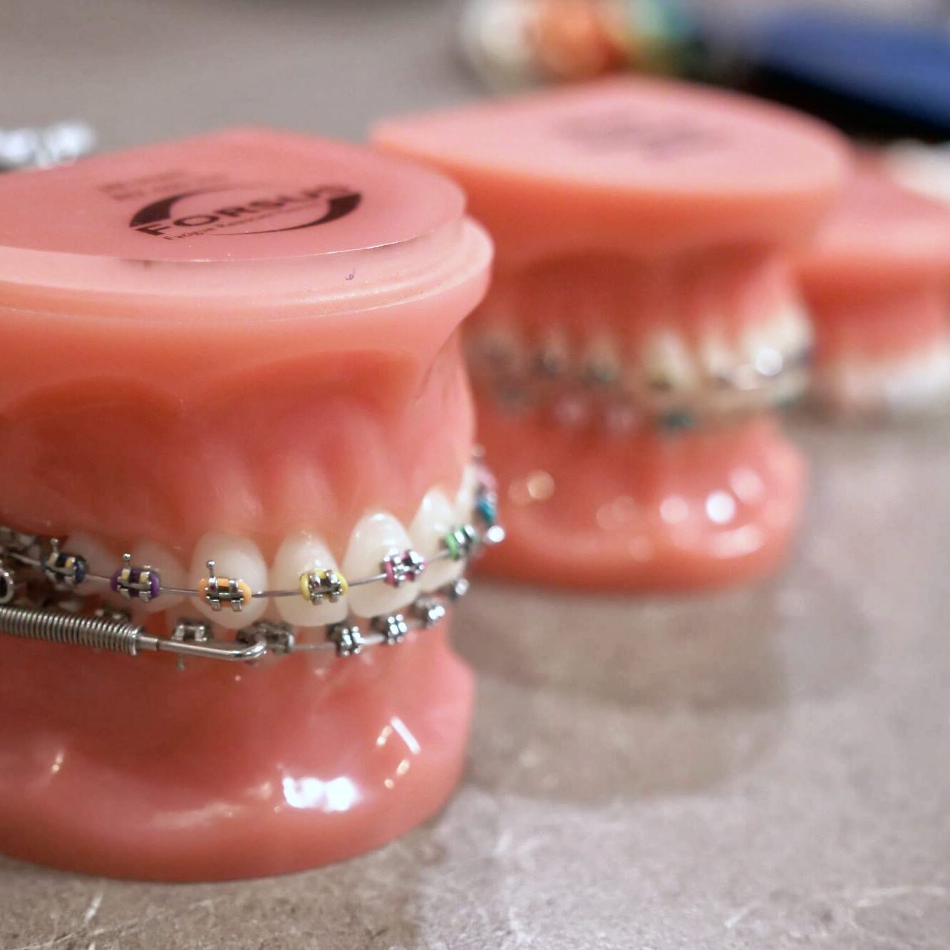 Teeth models with braces