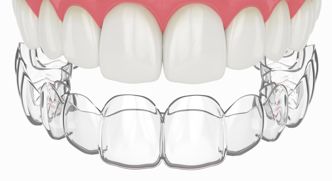 Clear aligner retainer