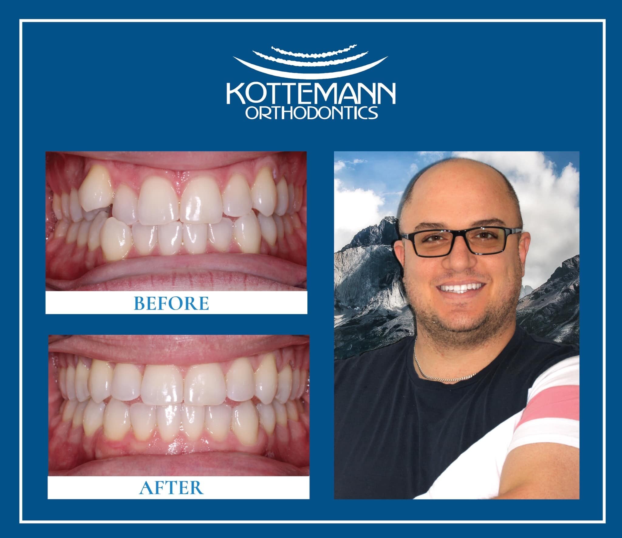 A before-and-after dental transformation showcases improved teeth alignment. A smiling person is shown beside a mountain backdrop. KOTTEMANN ORTHODONTICS is displayed.