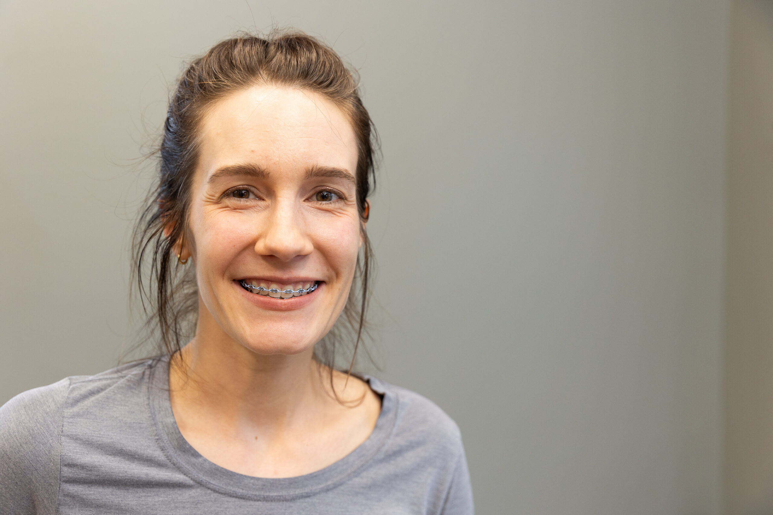 A person with braces smiles, wearing a gray shirt against a plain backdrop. The image focuses on their face and upper body.